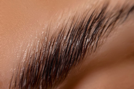 browlift